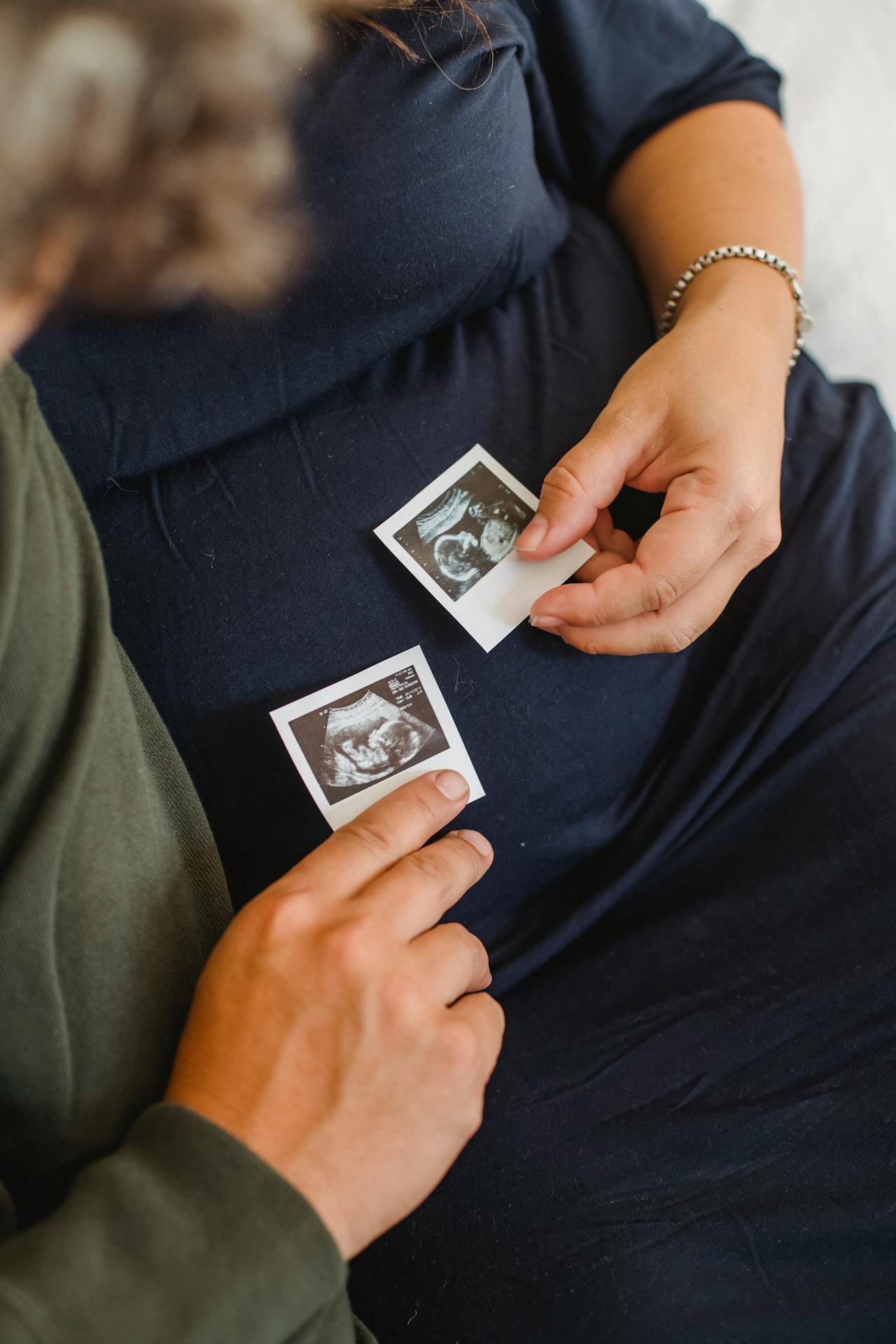 unusual pregnancy symptoms